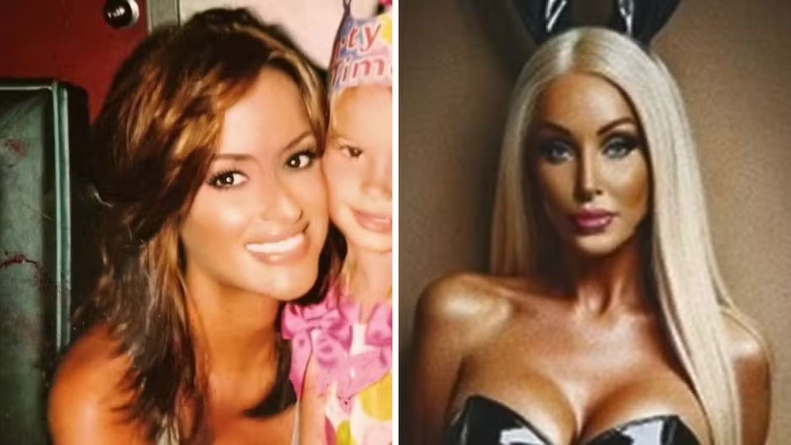 Modelo que gastou fortuna para "virar" Barbie agora é motorista de app