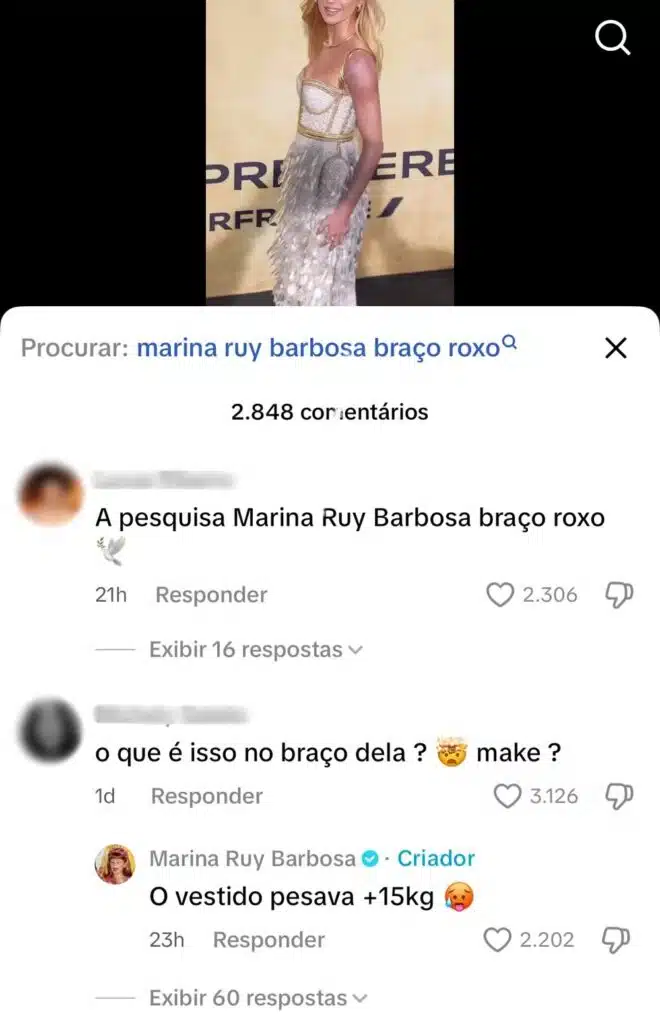 Marina Ruy Barbosa explica hematomas nos braços após gala em Cannes: vestido da Balmain pesava mais de 15 kg e causou impacto na circulação.